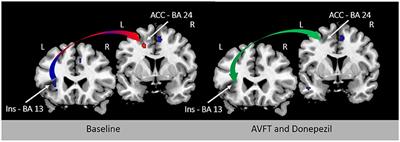 Commentary: Visual Feedback of Tongue Movement for Novel Speech Sound Learning